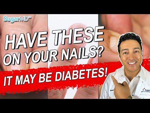 5 Diabetic Nail Problems & Top Signs of Diabetes on The Nails!