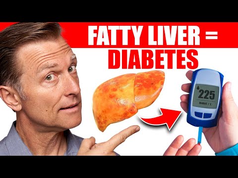 Your Fatty Liver Caused Your Diabetes