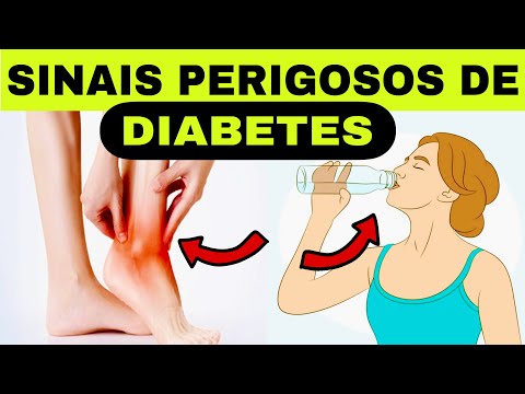 7 SINAIS MAIS PERIGOSOS de DIABETES (Açúcar muito alto no sangue) e VALORES dos EXAMES de DIABETES