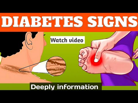 Diabetes symptoms। Diabetes Control tips। diabetes mellitus।